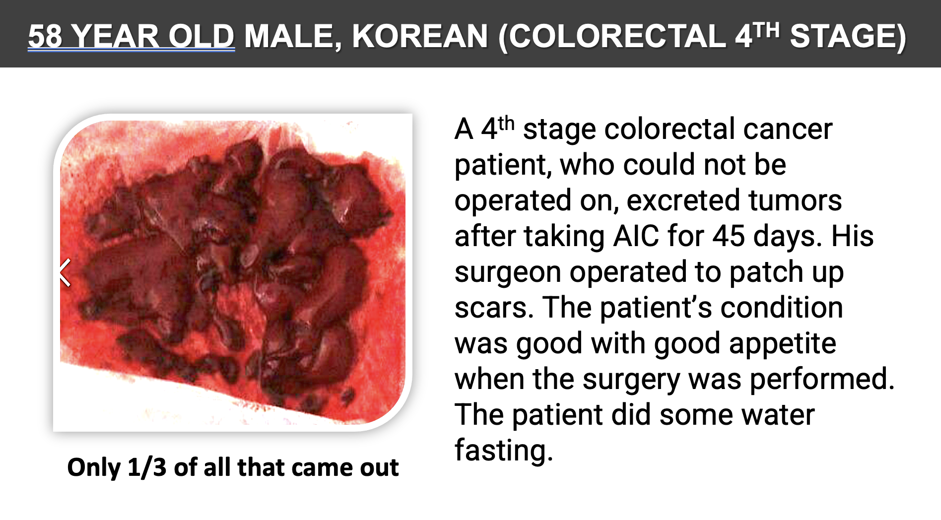 Figure 3 Tumor Excretion in Advanced Colorectal Cancer Following AIC Therapy.