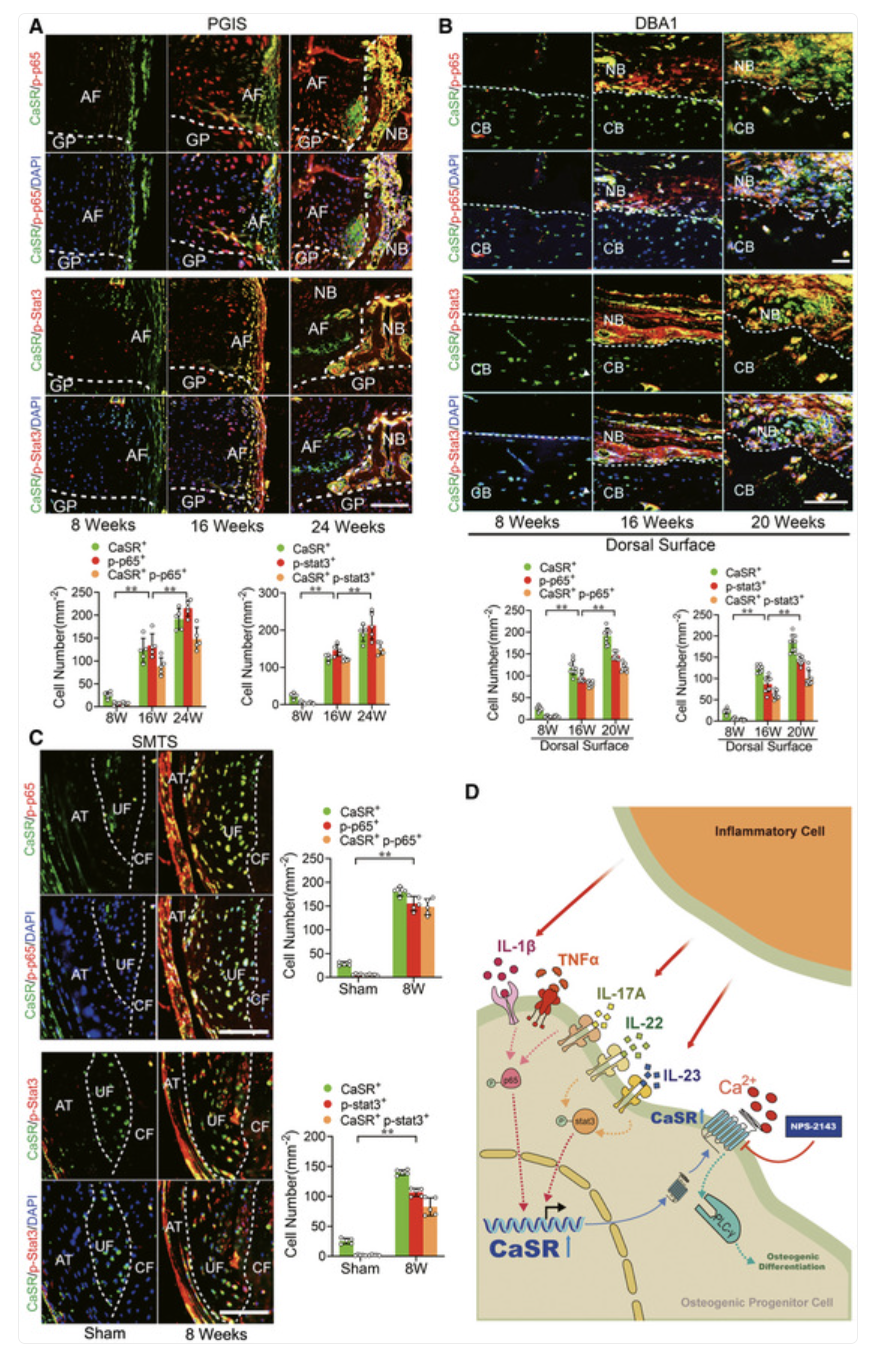 Figure 1. Inflammation drives abnormal bone formation through the calcium-sensing receptor
