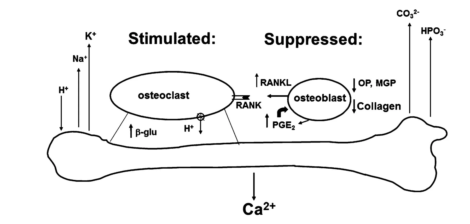 Figure 1 This figure illustrates the effects of metabolic acidosis on bone remodeling. In an acidic environment, osteoclasts are stimulated, leading to increase