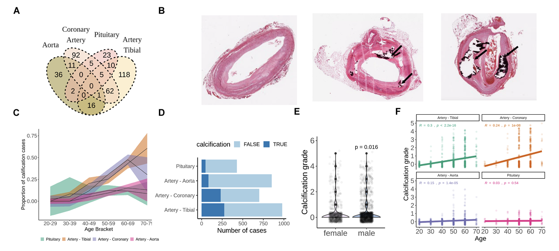 Figure 1. Age-Related Patterns of Soft Tissue Calcification Across Human Organs