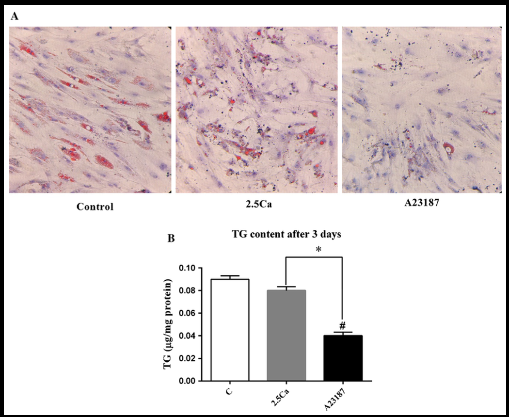 Figure 1. Calcium and ionophore reduce adipocyte lipid droplets and triglyceride levels