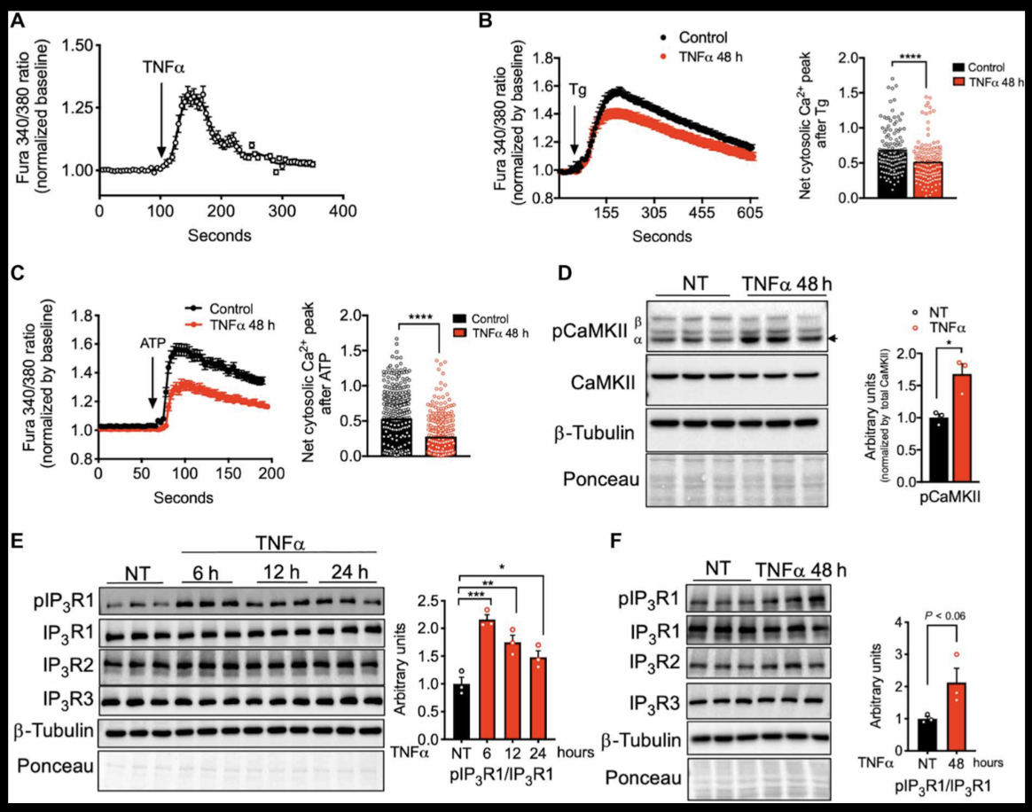 Figure 2. How Inflammation Rewires Calcium Signaling Inside Fat Cells