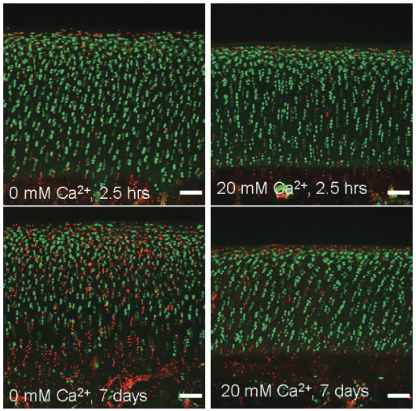 Figure 2. Extracellular Calcium Modulates Early and Delayed Chondrocyte Loss