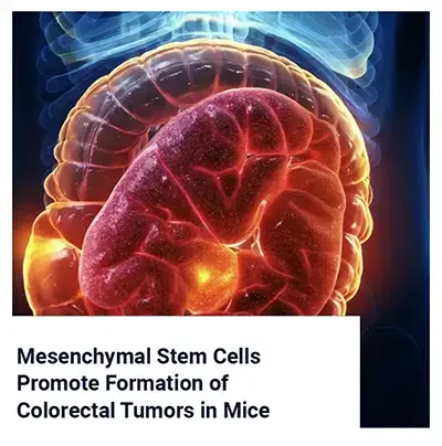 Mesenchymal Stem Cells Promote Formation of Colorectal Tumors in Mice
