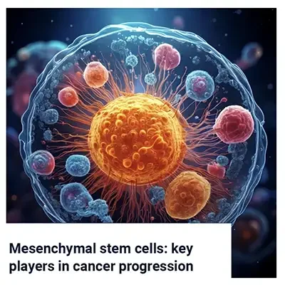 Mesenchymal Stem Cells: Key Players in Cancer Progression
