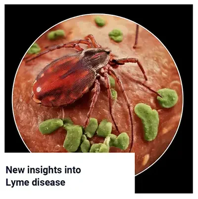 Calcium and Lyme Disease