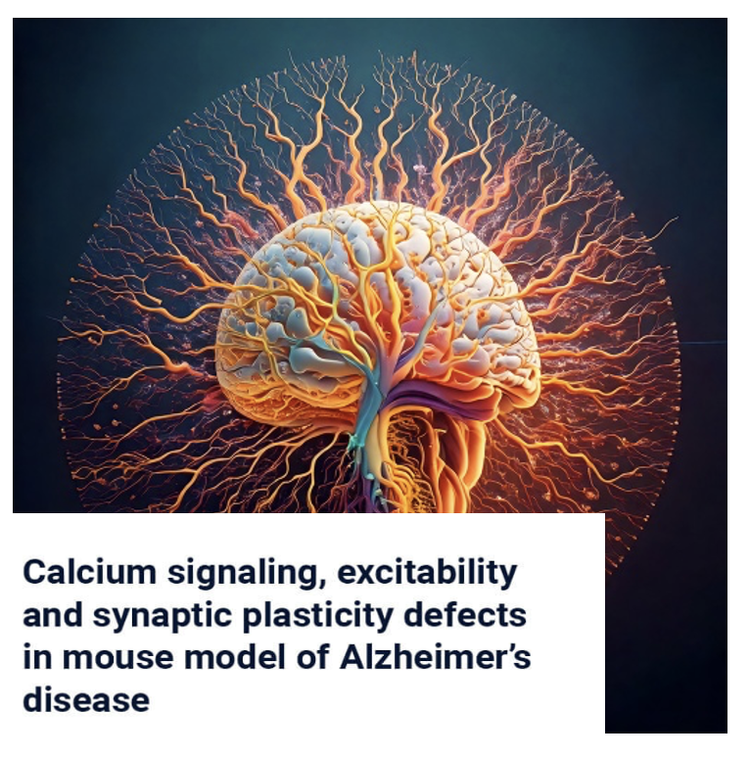 Calcium Signaling and Synaptic Plasticity in Alzheimer's Disease