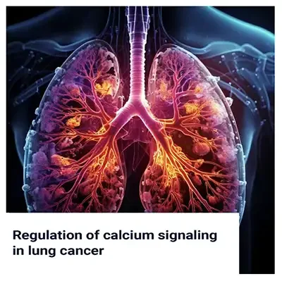 Calcium Signaling in Lung Cancer